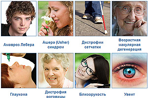ДНК тесты глазных болезней