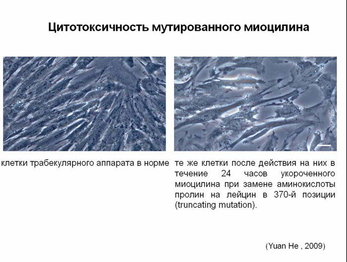 цитотоксичность мутированного миоцилина