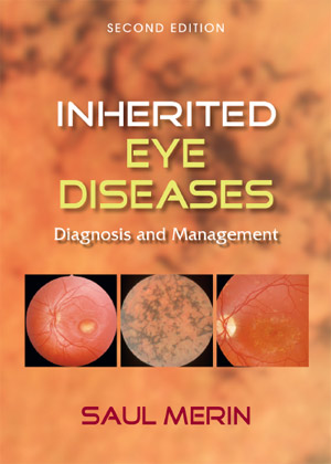 inherited eye diseases